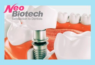 Имплантация «под ключ»: имплант «NEOBIOTECH» + металлокерами