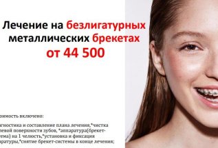 Лечение на безлигатурных металлических брекетах от 44 500 р.