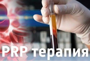 PRP терапия