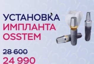 Установка импланта Osstem за 24990 руб.