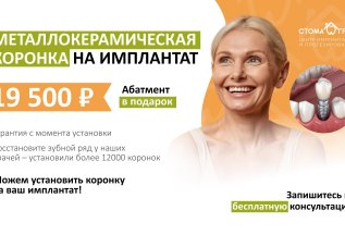 Зуб под ключ! Металлокерамическая коронка на импланте