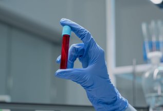 Анализы на половые инфекции от 450 рублей