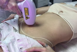 Лазерная эпиляция комплекс 