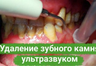 Консультация любого стоматолога-бесплатная