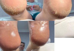Акция! Smart педикюр Spa комплекс всего 1800 руб вместо 2100