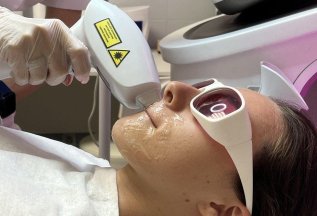 Лазерная эпиляция комплекс 