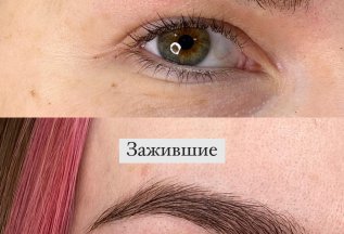Заживляющая уходовая косметика каждому клиенту!