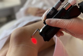 Лазерная эпиляция любой зоны за 2990 рублей