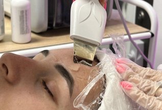Лазерная эпиляция комплекс 