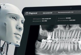 Применяем искусственный интеллект Diagnocat