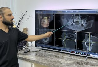 Бесплатная консультация 3-х специалистов