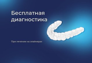 Бесплатная диагностика при лечении на элайнерах
