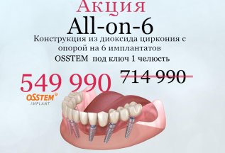 Конструкция с опорой на 6 имплантатов из диоксида циркония