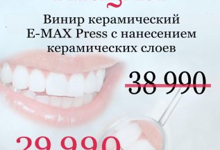 Винир керамический E-MAX