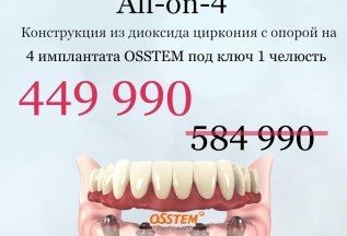 Конструкция с опорой на 4 имплантата из диоксида циркония
