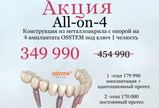 Конструкция с опорой на 4 импланта с адаптационным протезом