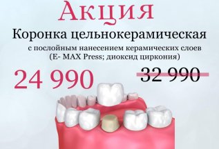 Акция! Коронка/зуб цельнокерамическая с послойным нанесением