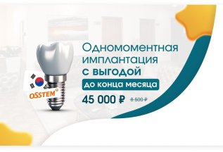 Выгодная имплантация!