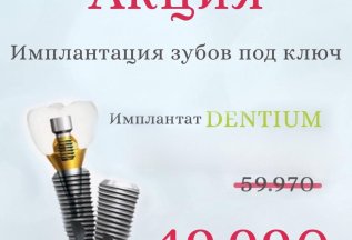 Имплантация зубов под ключ DENTIUM