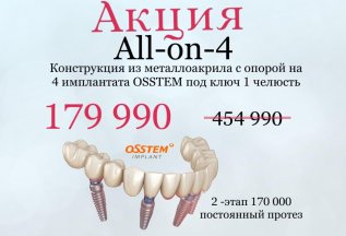 Конструкция с опорой на 4 импланта с адаптационным протезом