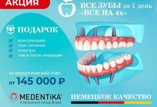 Все зубы за 1 день по системе 