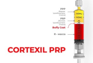 Лечебное PRP суставов по методике Cortexil