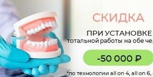 Получите 50000р скидку на полную имплантацию