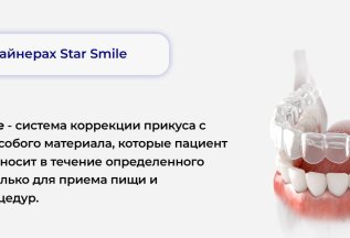 Элайнеры Star smile - система коррекции прикуса