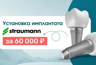 Установка имплантата Straumann по приятной цене!