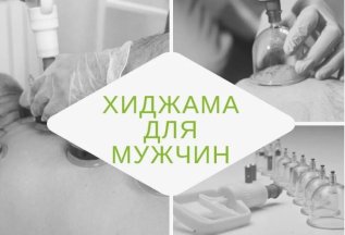 Скидка 20% на хиджаму для мужчин
