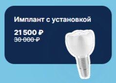 Имплант с установкой по специальной цене