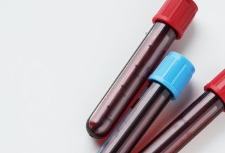 Биохимия 13 показателей и 21 показатель по специальной цене⭐