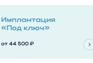 Имплантация 