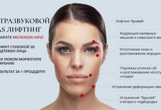 SМАS лифтинг MICROSON макро-молодость