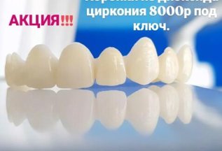 АКЦИЯ! Коронки из диоксида циркония 8000 р под ключ.