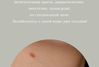 «Нет папиллом»: комплексное удаление за 7500 рублей!