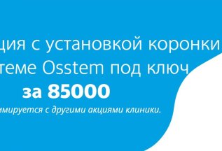 Имплантация Osstem под ключ за 85000