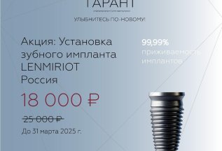 Установка зубного импланта Lenmiriot