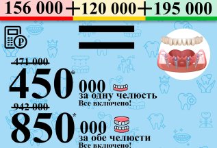 Имплантация все на 4х