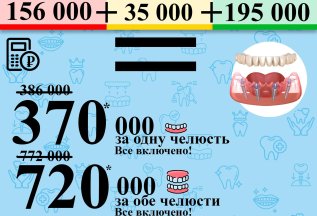 Имплантация все на 4х