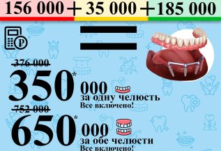 Имплантация все на 4х!