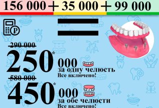 Имплантация все на 4х!