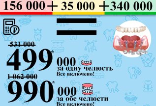 Имплантация все на 4х