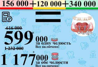 Имплантация все на 4х