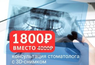 Консультация любого стоматолога с 3D-снимком