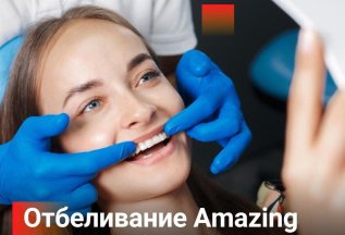 Отбеливание зубов