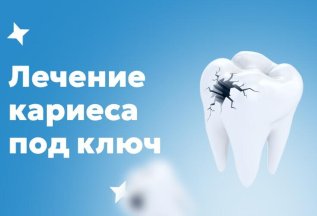 Лечение кариеса под ключ