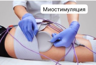 Миостимуляция