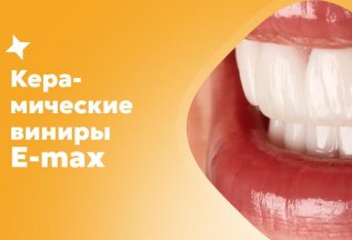 Керамические виниры E-max