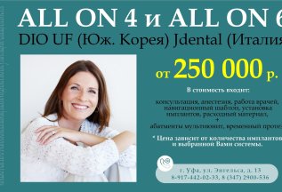 Имплантация методом all in 4 и all in 6 от 250 000 р.